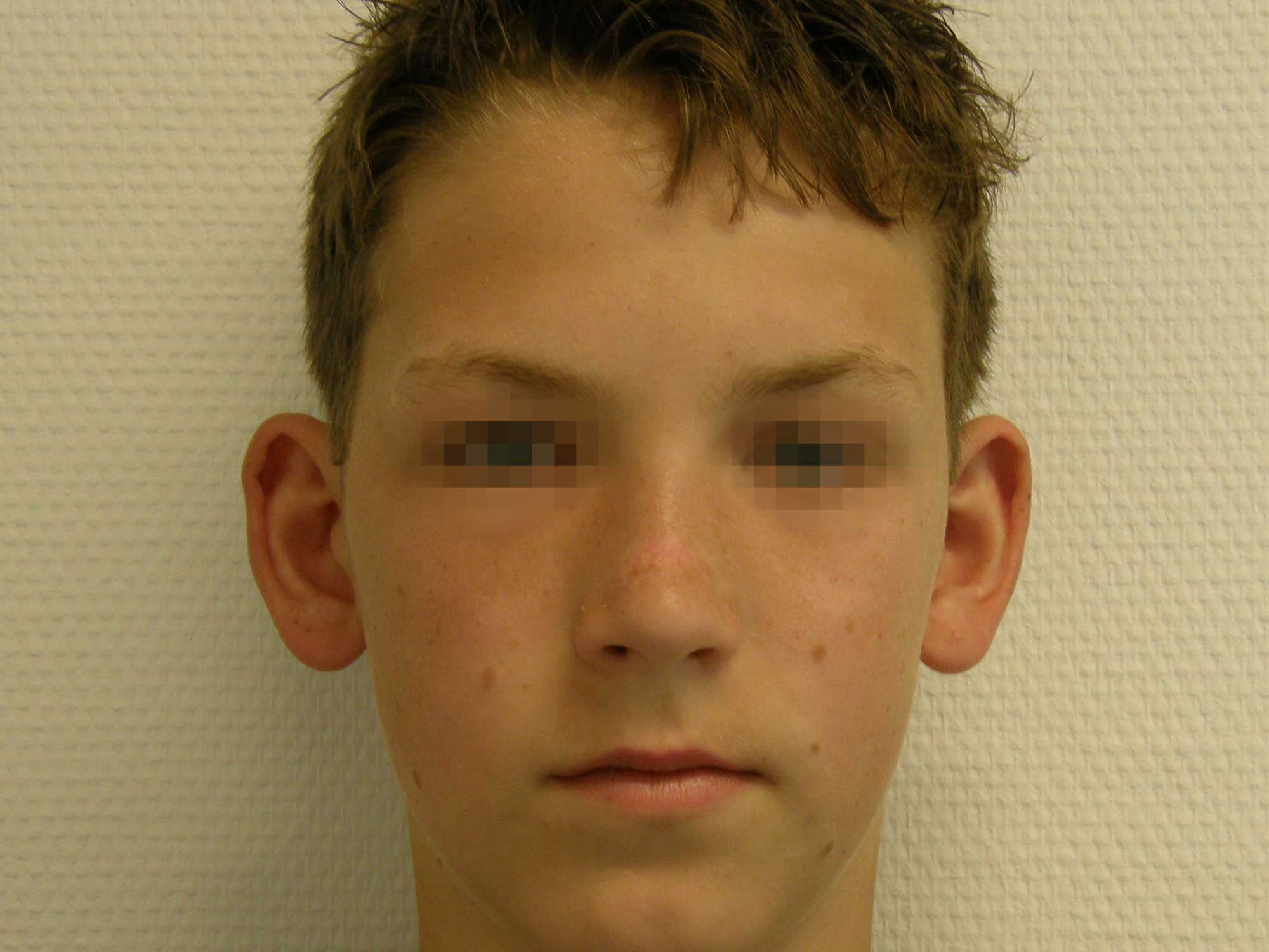Vorher